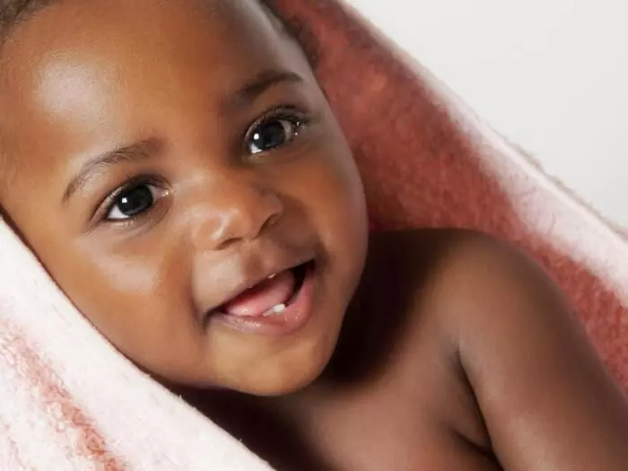 Infant teething not associated with diarrhoea – Paediatrician