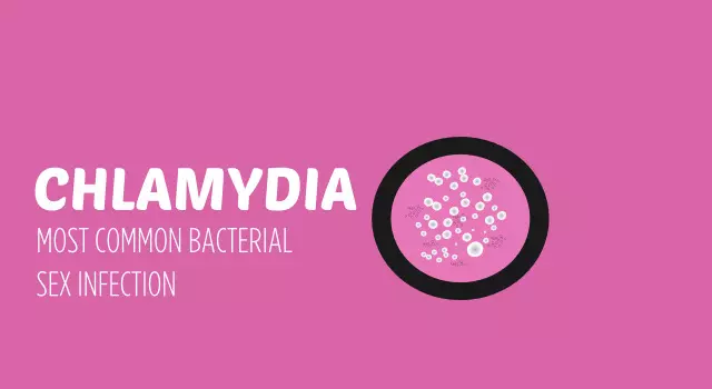Expert urges early treatment of Chlamydia to avoid complications