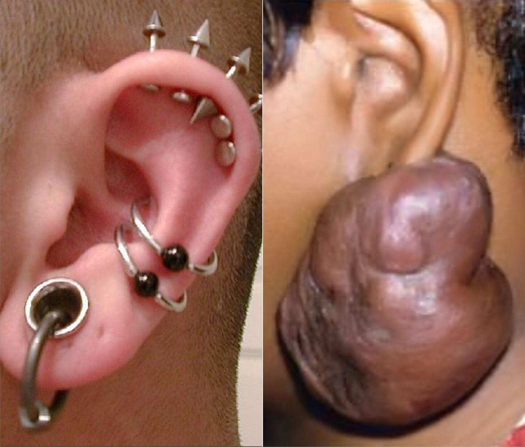 Earrings for Sensitive Ears: Your Ultimate Guide