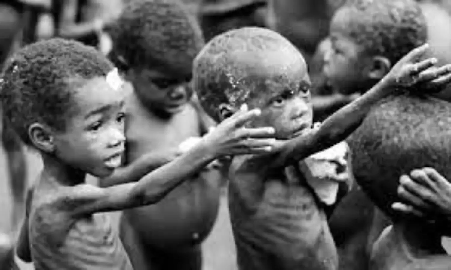 Poverty, Unemployment Major Causes of Child Malnutrition in Nigeria – Nutritionist
