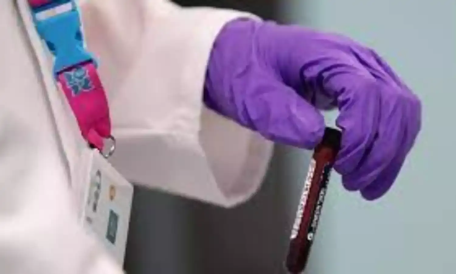 U.S. Anti-doping Chief Wants More Transparency in Testing