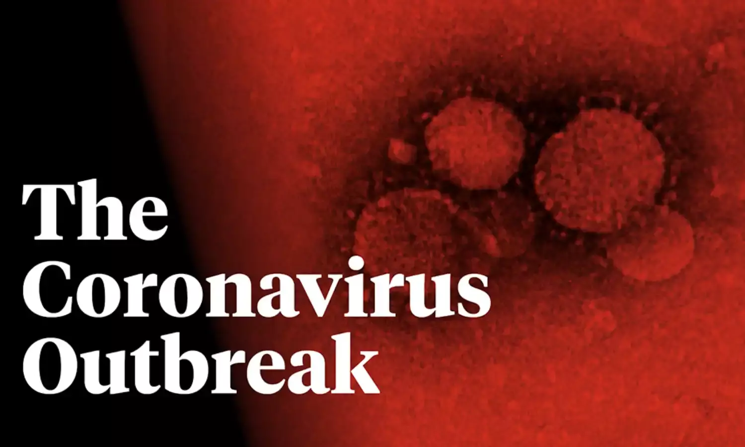 Report reveals incompetent U.S. pandemic containment in 2020