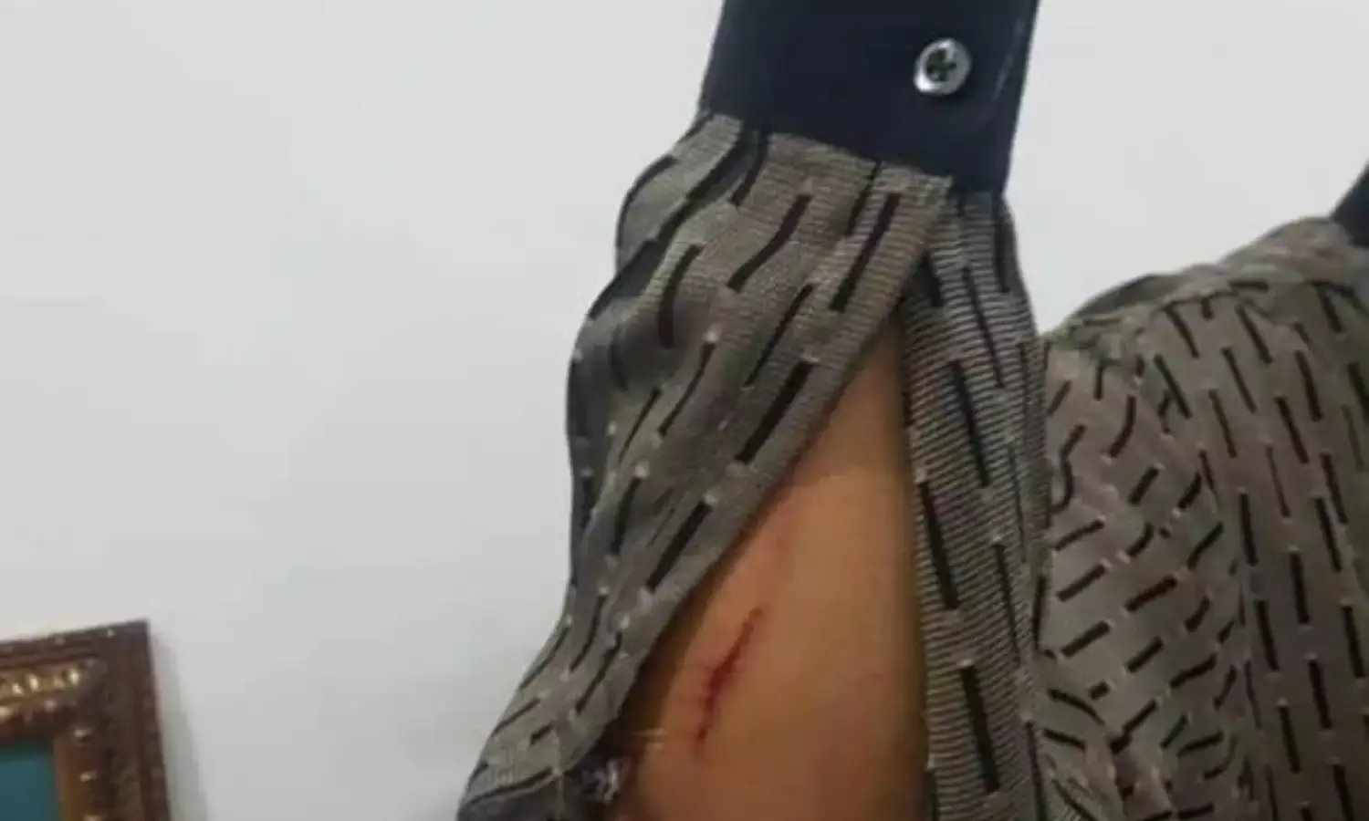 Former Rivers State Governor injured as Party faithfuls Clash +Photos, Video.