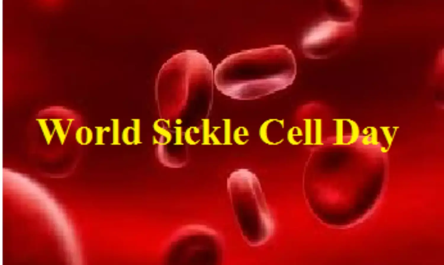 World Sickle Cell Day