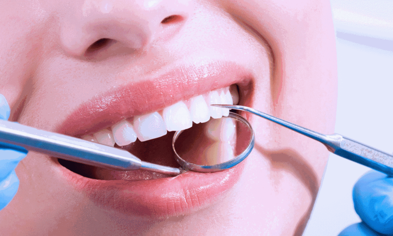 Expert calls for proper mouth care to avoid diseases