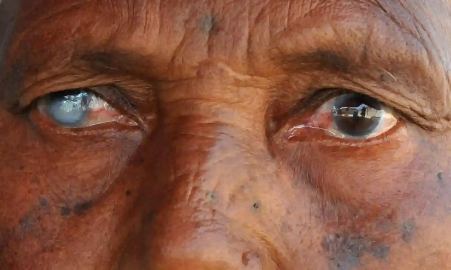 Nigerian university don develops blindness detection kits