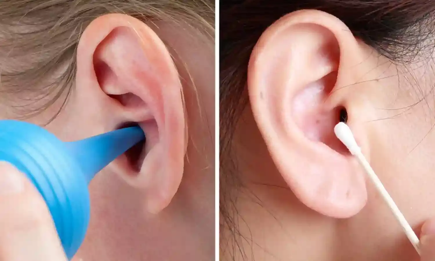 ENT expert speaks on health implications of removing earwax