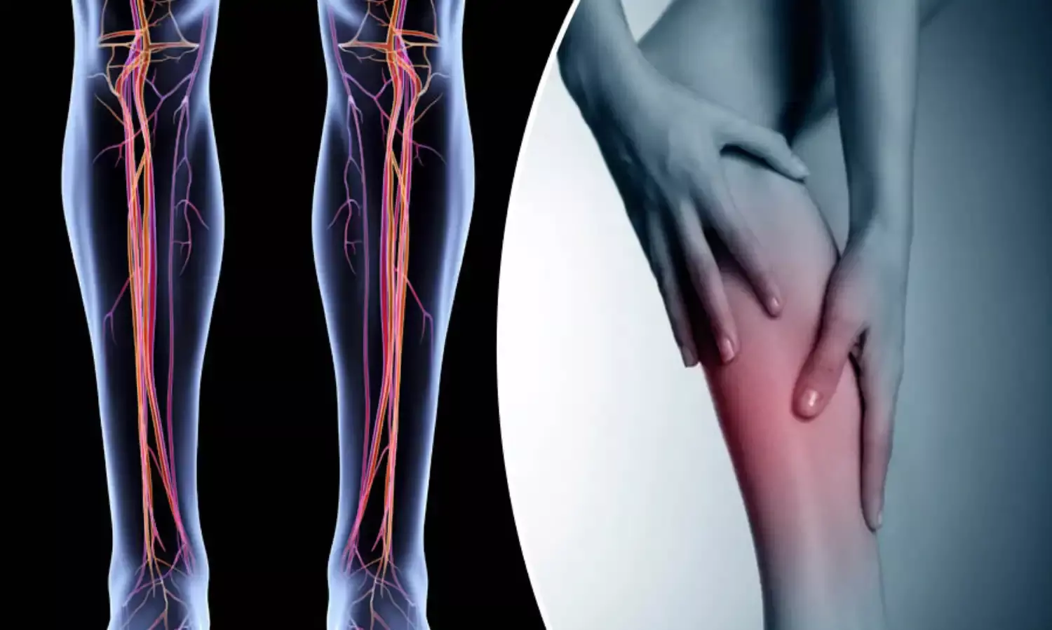 Medical expert urges early treatment of deep vein thrombosis