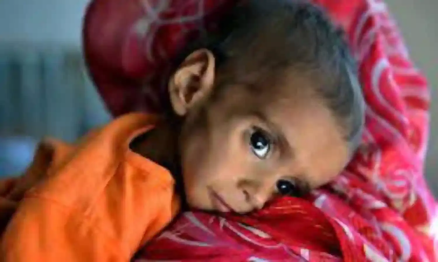 Children suffer malnutrition in Afghanistan