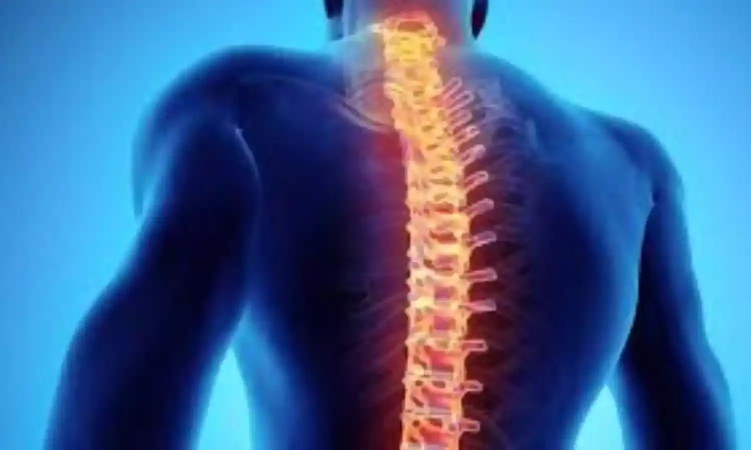 Prevention, best way to stem Spinal Cord injury cases- Victims