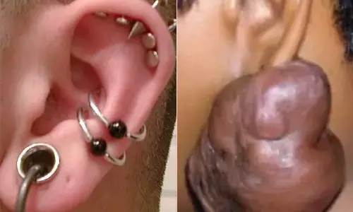 Effects of Multiple Ear Piercing