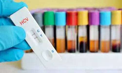 Impact of COVID-19 on viral hepatitis